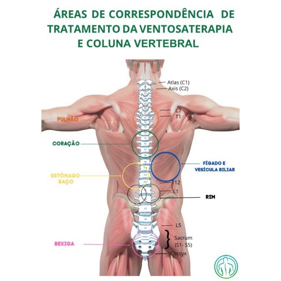 Mapa Ventosaterapia Áreas Correspondente Tratamento E Coluna Vertebral Regiões