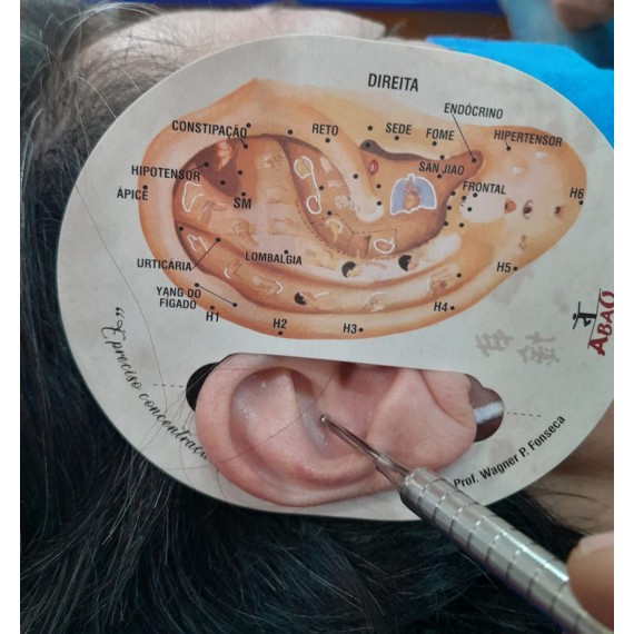 Gabarito Auricular - Prof. Wagner P. Fonseca