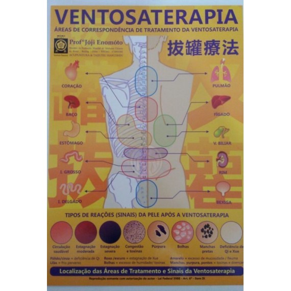 Mapa De Ventosaterapia Plastificado - Prof Enómoto 